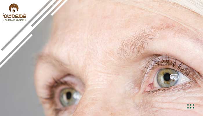 اثر قهوه بر کاهش ریسک ابتلا به بیماری های چشم