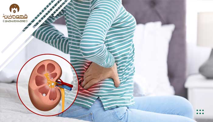 کاهش خطر ابتلا به سنگ کلیه با قهوه